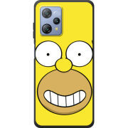 Чохол BoxFace Blackview A53 