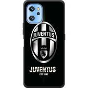 Чехол BoxFace Umidigi A13 / A13 Pro 