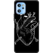 Чехол BoxFace Umidigi A13 / A13 Pro 