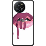 Чохол BoxFace Blackview Shark 8 