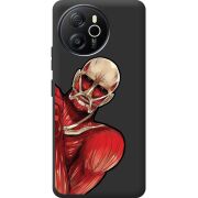 Прозорий чохол BoxFace Blackview Oscal Tiger 12 Титан