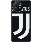 Чохол BoxFace Blackview Oscal Tiger 12 FC J