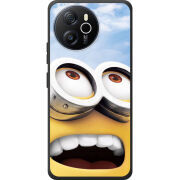 Чохол BoxFace Blackview Oscal Tiger 12 