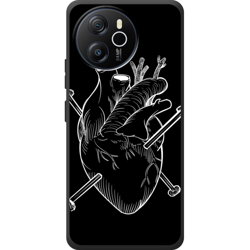 Чохол BoxFace Blackview Oscal Tiger 12 