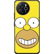 Чохол BoxFace Blackview Oscal Tiger 12 