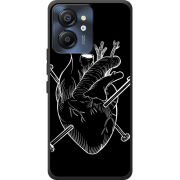 Чохол BoxFace Blackview Color 8 