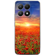 Чохол BoxFace Xiaomi 15T 