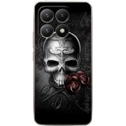 Чохол BoxFace Xiaomi 15T 