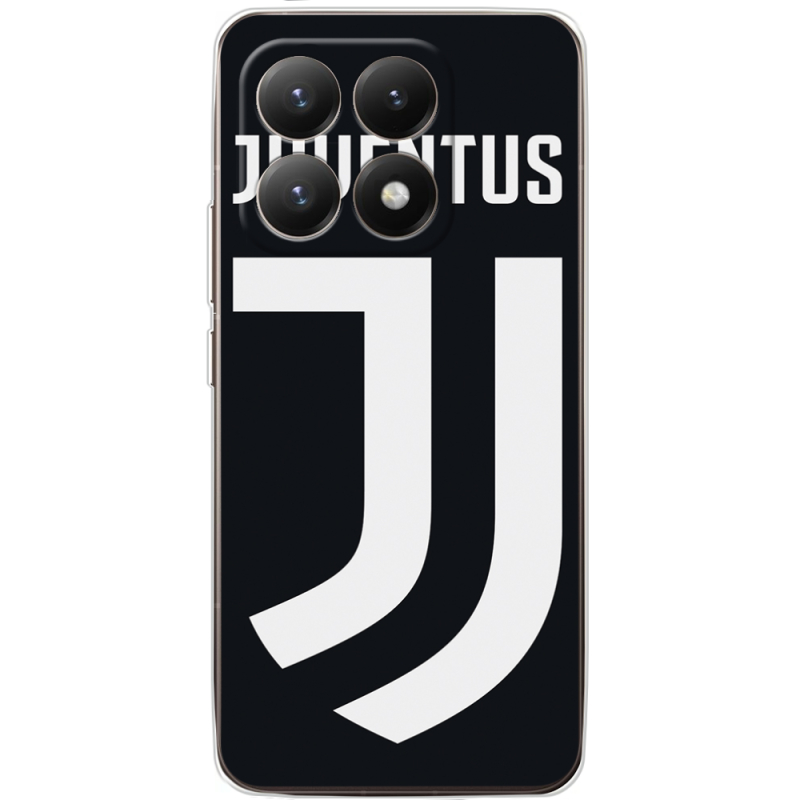 Чохол BoxFace Xiaomi 15T FC J