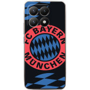 Чохол BoxFace Xiaomi 15T FC Bayern