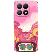 Чохол BoxFace Xiaomi 15T 