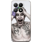 Чохол BoxFace Xiaomi 15T 