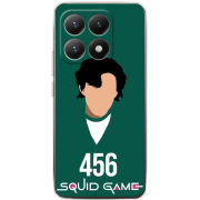 Чохол BoxFace Xiaomi 15T siquid game 456