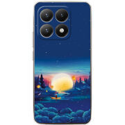 Чохол BoxFace Xiaomi 15T Спокойной ночи