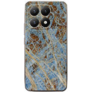 Чохол BoxFace Xiaomi 15T 