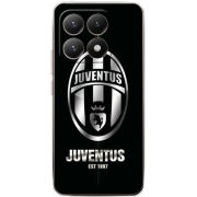 Чохол BoxFace Xiaomi 15T 