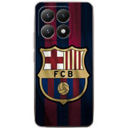 Чохол BoxFace Xiaomi 15T 