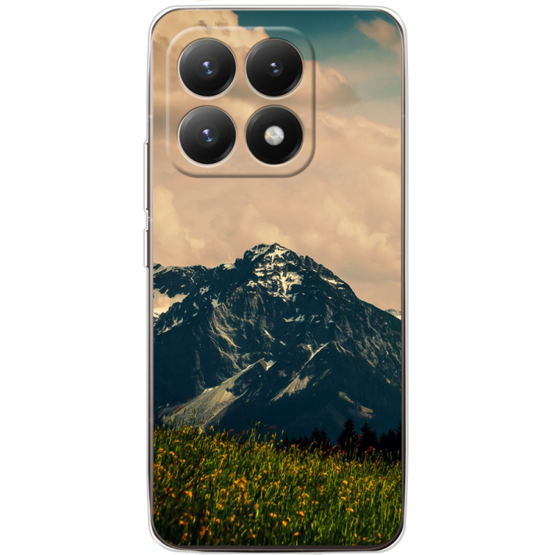 Чохол BoxFace Xiaomi 15T 