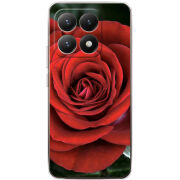 Чохол BoxFace Xiaomi 15T 