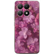 Чохол BoxFace Xiaomi 15T 