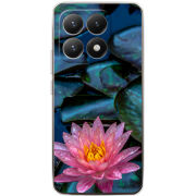 Чохол BoxFace Xiaomi 15T 