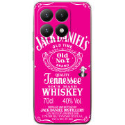 Чохол BoxFace Xiaomi 15T 