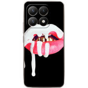 Чохол BoxFace Xiaomi 15T 