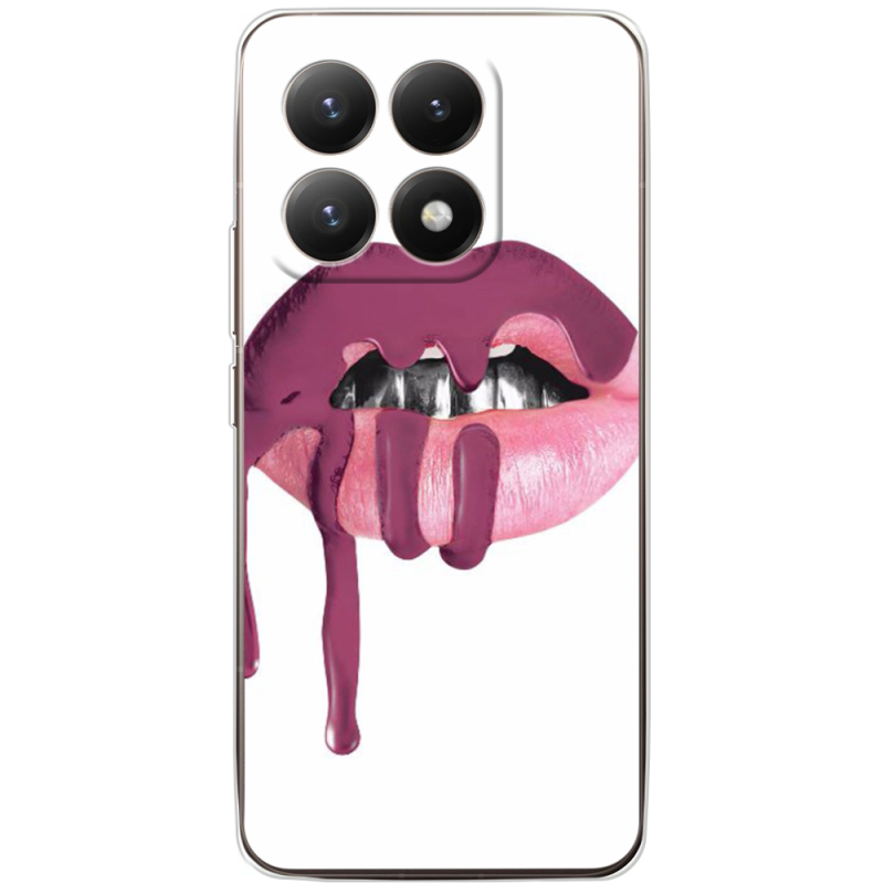 Чохол BoxFace Xiaomi 15T 