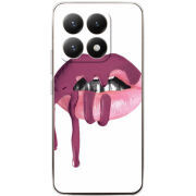 Чохол BoxFace Xiaomi 15T 