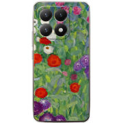 Чохол BoxFace Xiaomi 15T 