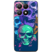 Чохол BoxFace Xiaomi 15T 