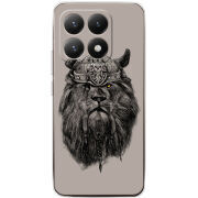 Чохол BoxFace Xiaomi 15T 