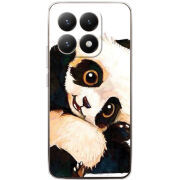 Чохол BoxFace Xiaomi 15T 