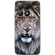 Чохол BoxFace Xiaomi 15T 