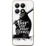 Чохол BoxFace Xiaomi 15T 