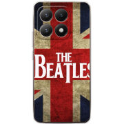 Чохол BoxFace Xiaomi 15T 