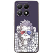 Чохол BoxFace Xiaomi 15T 