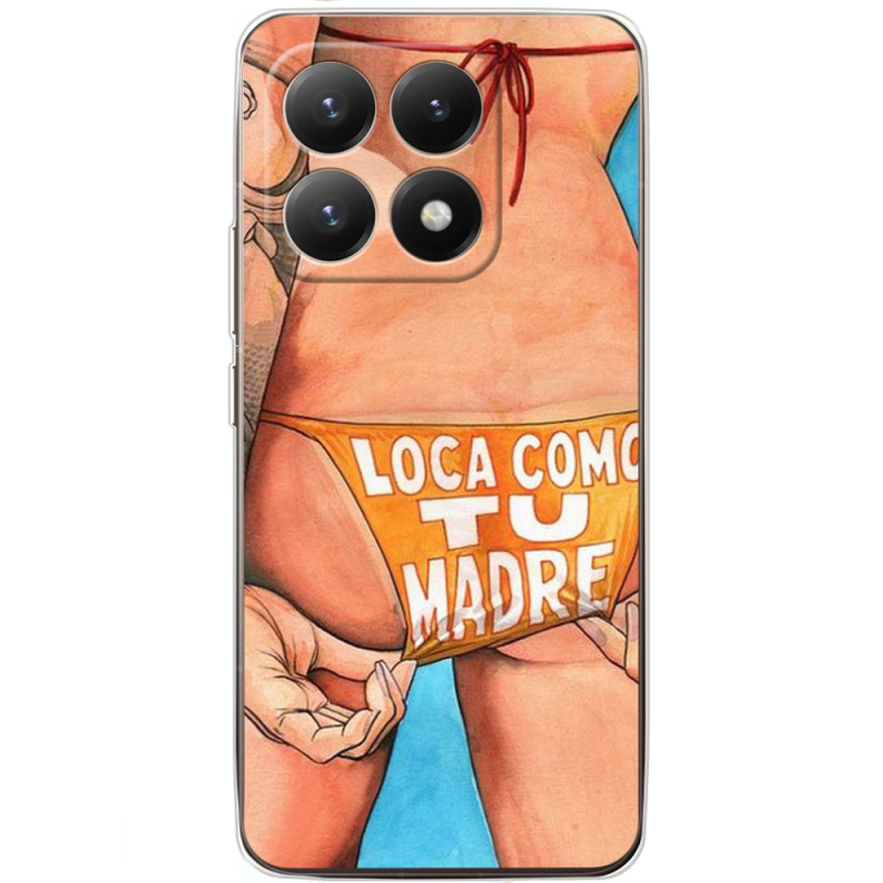 Чохол BoxFace Xiaomi 15T 