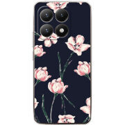 Чохол BoxFace Xiaomi 15T 