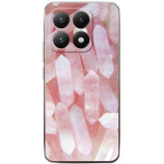 Чохол BoxFace Xiaomi 15T 