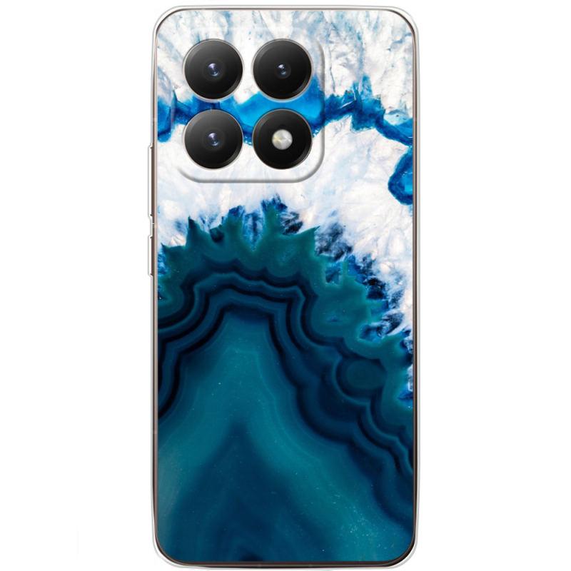 Чохол BoxFace Xiaomi 15T 