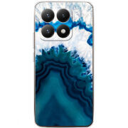 Чохол BoxFace Xiaomi 15T 