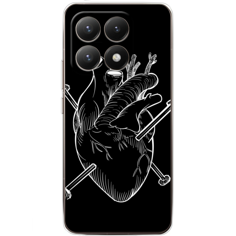 Чохол BoxFace Xiaomi 15T 