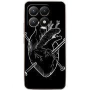 Чохол BoxFace Xiaomi 15T 