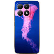 Чохол BoxFace Xiaomi 15T 