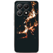 Чохол BoxFace Xiaomi 15T 