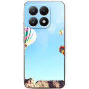 Чохол BoxFace Xiaomi 15T 