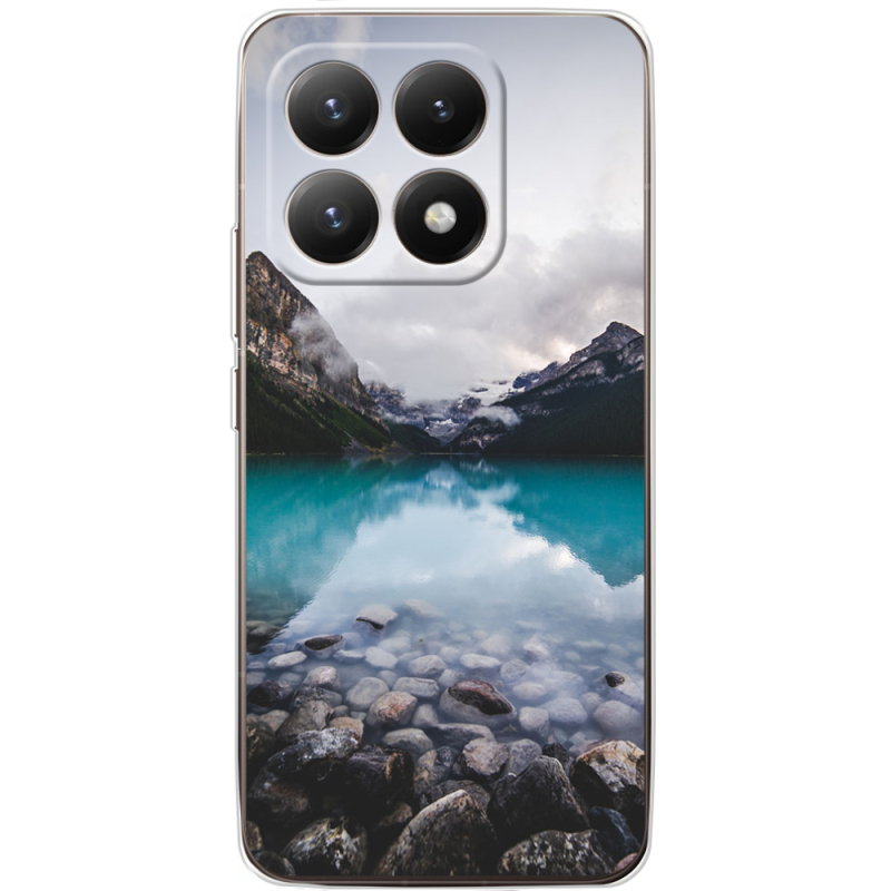 Чохол BoxFace Xiaomi 15T 