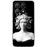 Чохол BoxFace Xiaomi 15T 