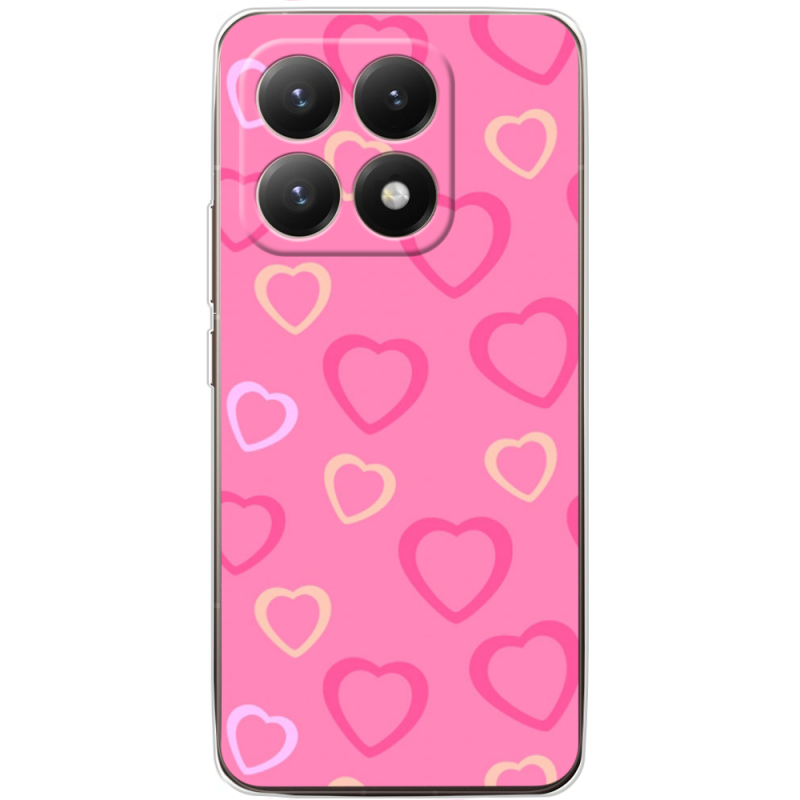 Чохол BoxFace Xiaomi 15T Sugar Hearts